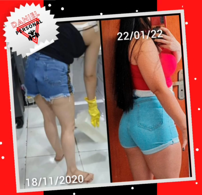 Antes e depois 5